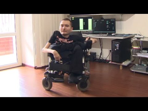 russian man to undergo revolutionary surgery