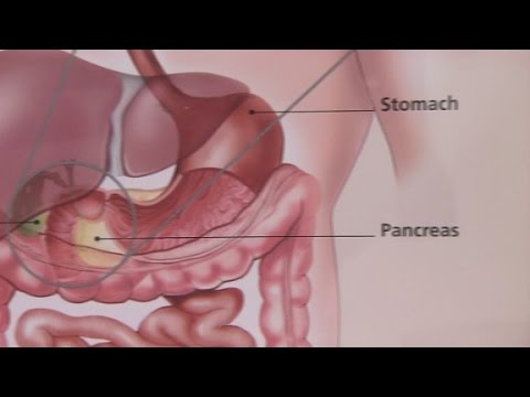 irritable bowel syndromeits symptoms