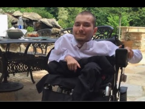 russian volunteer to have worlds first head transplant